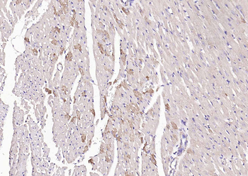 Angiopoietin 1 antibody