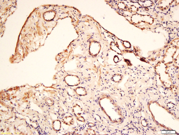 Angiopoietin 1 antibody