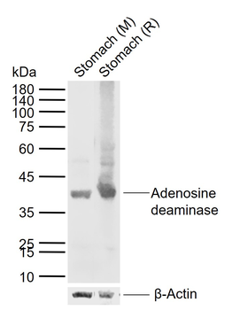 ADA antibody