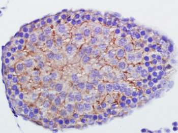 Annexin V antibody