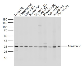 Annexin V antibody