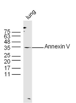 Annexin V antibody