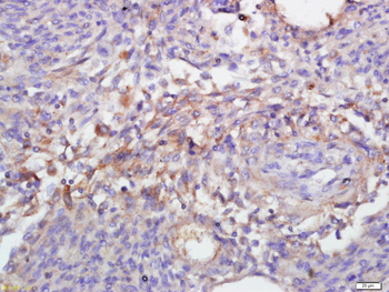 Annexin V antibody