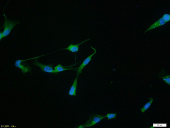 MMP-2 antibody