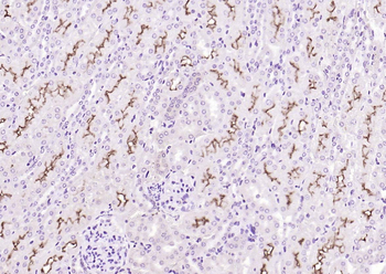 Klotho antibody