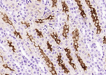 Klotho antibody