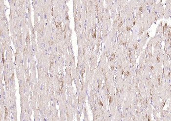 TNMD antibody