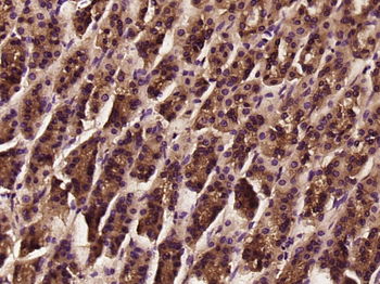 TNMD antibody