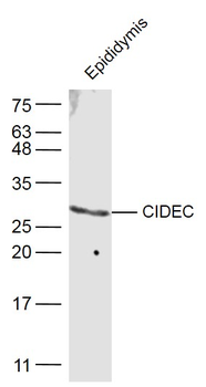 CIDEC antibody