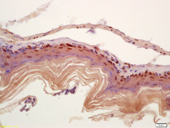 CIDEC antibody