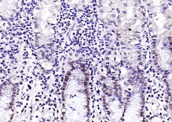 CIDEC antibody