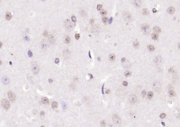 CIDEC antibody