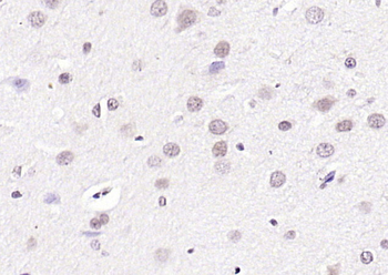 CIDEC antibody