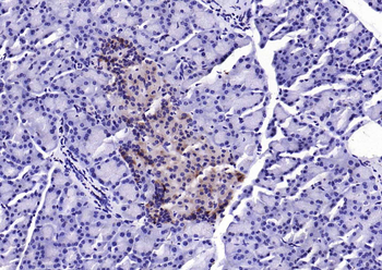 EIF4B antibody