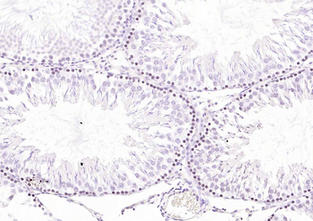 CDCA5 antibody