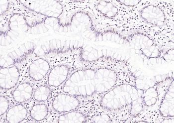 CDCA5 antibody