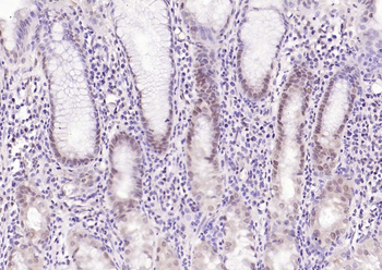 CDCA5 antibody