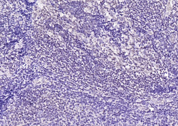 CDCA5 antibody