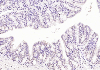 CDCA5 antibody