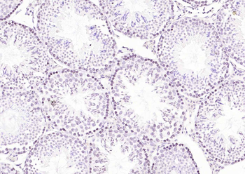 CDCA5 antibody