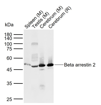 beta Arrestin 2 antibody