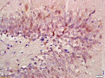 beta Arrestin 2 antibody