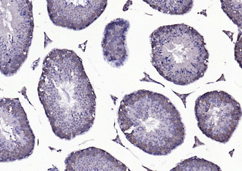 beta Arrestin 2 antibody