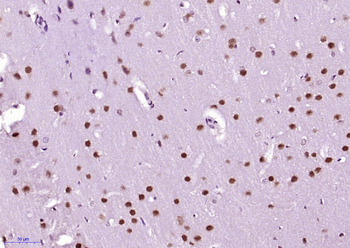 beta Arrestin 2 antibody