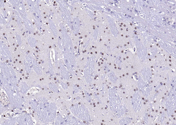 beta Arrestin 2 antibody