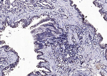 beta Arrestin 2 antibody