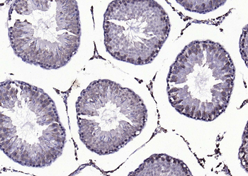 beta Arrestin 2 antibody