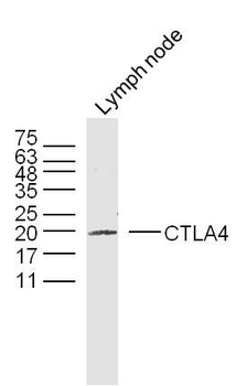 Tumor Immunity Characterization Assembly kit antibody