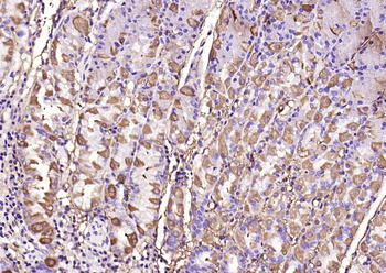 MMP-1 antibody