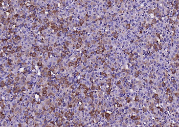 MMP-1 antibody