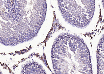 MMP-1 antibody