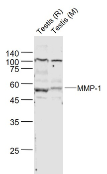 MMP-1 antibody