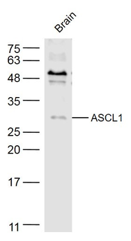 MASH1/Achaete-scute homolog 1 antibody