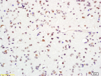 MASH1/Achaete-scute homolog 1 antibody