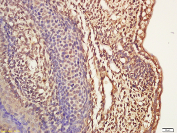 MASH1/Achaete-scute homolog 1 antibody