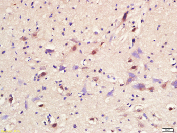 MASH1/Achaete-scute homolog 1 antibody