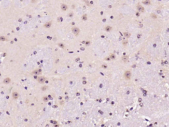 Ferritin antibody