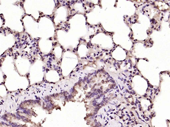 Ferritin antibody