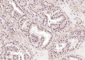 ATF2 antibody