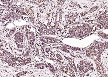 ATF2 antibody