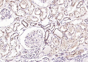 ATF2 antibody