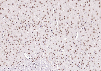 ATF2 antibody