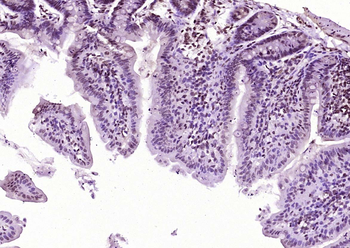 ATF2 antibody