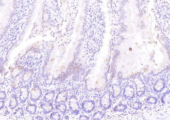 ATF4 antibody