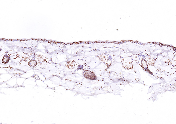 ATF4 antibody