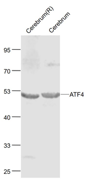 ATF4 antibody